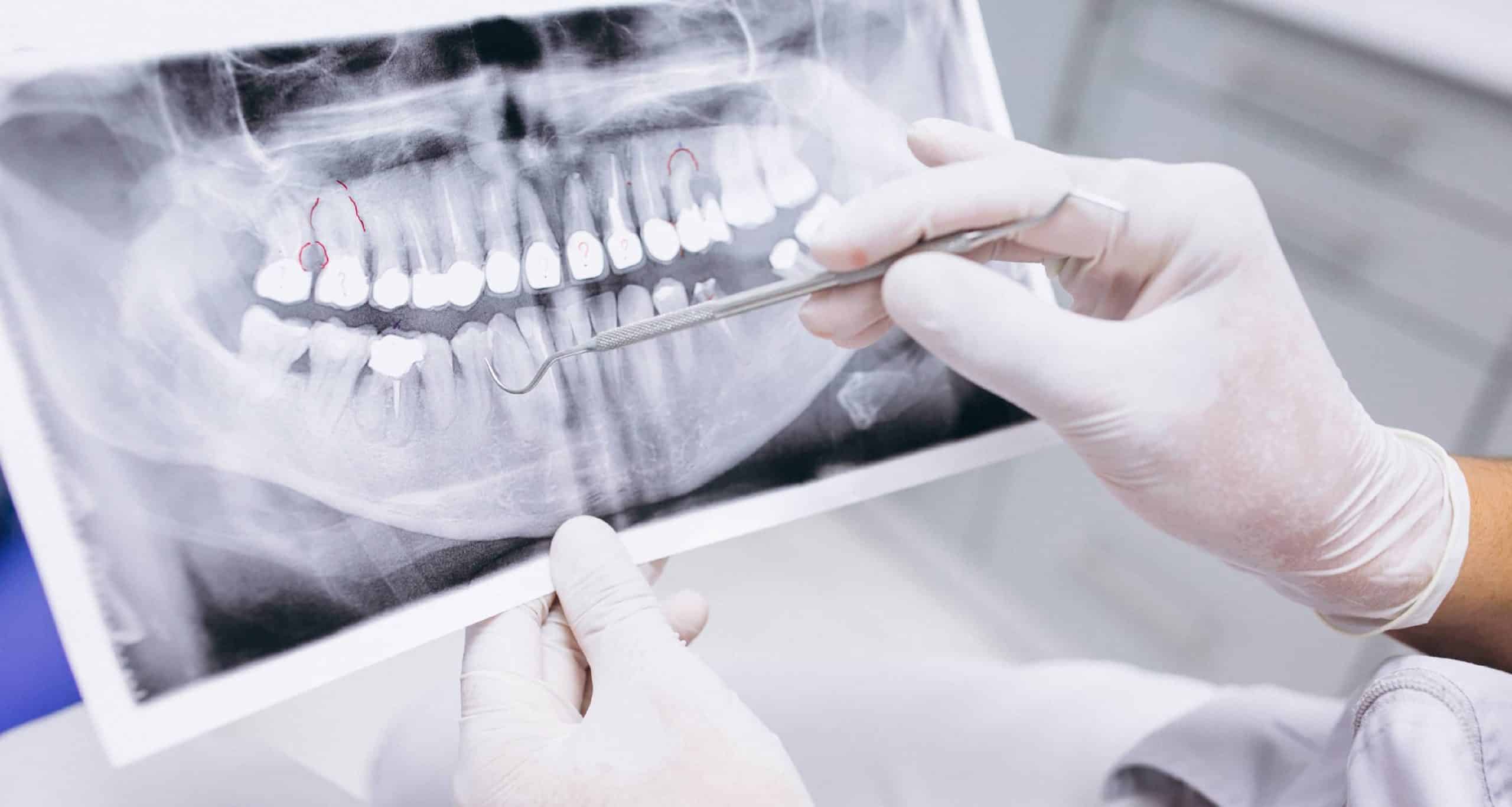 طب الأسنان